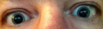 Eyes